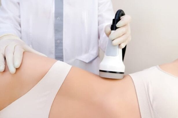 What-Can-You-Expect-After-Fat-Reduction-Treatment