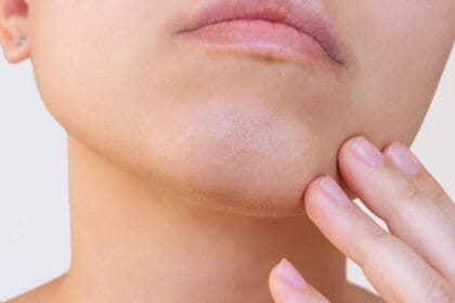 What-Makes-You-a-Good-Candidate-for-Double-Chin-Liposuction