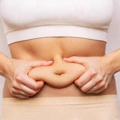 What-Mini-Abdominoplasty-Does-for-Belly-Bulges-Below-the-Navel