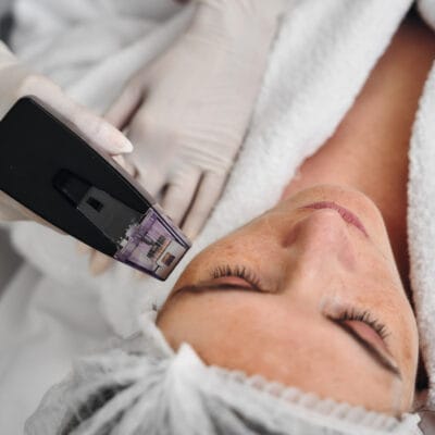 What-Morpheus-8-Treatment-can-fix-on-your-face