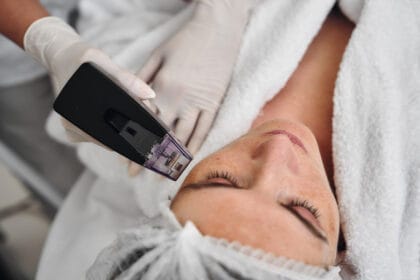 What-Morpheus-8-Treatment-can-fix-on-your-face