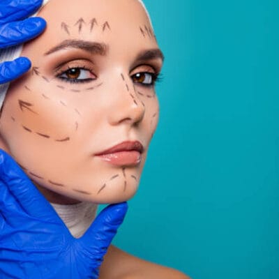 What-Results-Can-You-Expect-After-a-Facelift