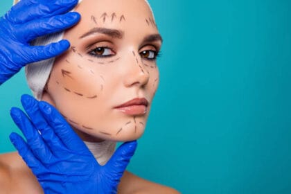 What-Results-Can-You-Expect-After-a-Facelift