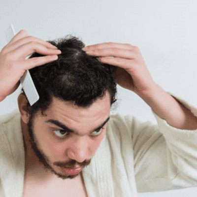 What-Should-You-Avoid-After-Hair-Loss-Treatment