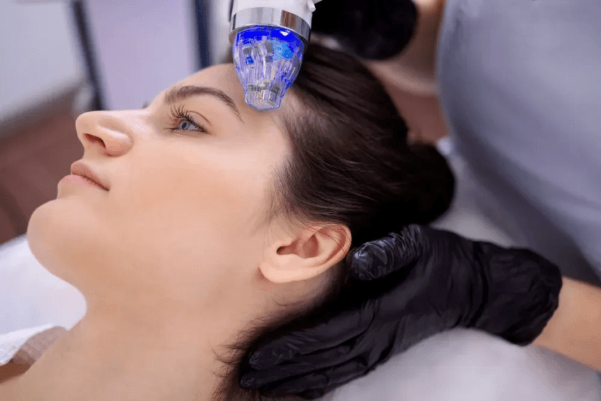 What-Should-You-Avoid-After-RF-Micro-Needling