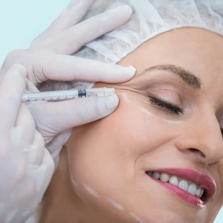 Wrinkle-Smoothing-for-a-Refreshed-Appearance