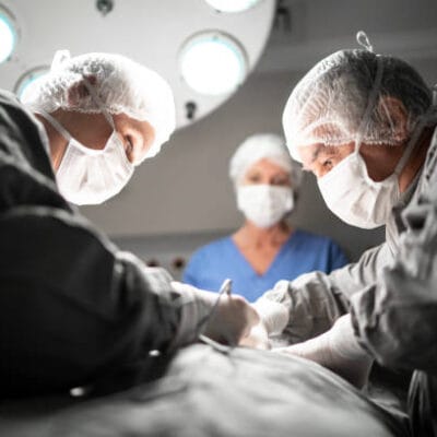 Liposuction surgery in Dubai
