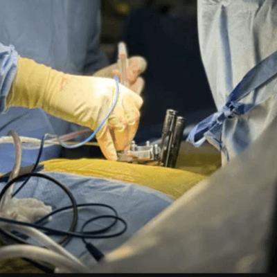 minimally-invasive-spine-surgery