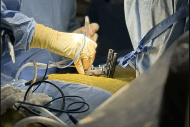 minimally-invasive-spine-surgery