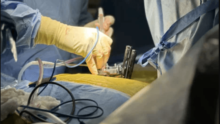 minimally-invasive-spine-surgery