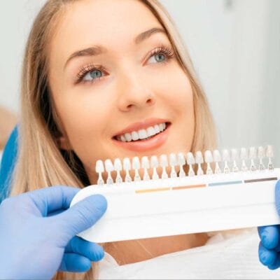 veneers