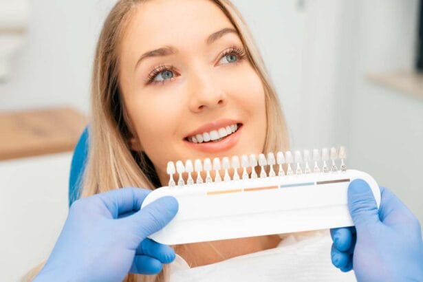 veneers