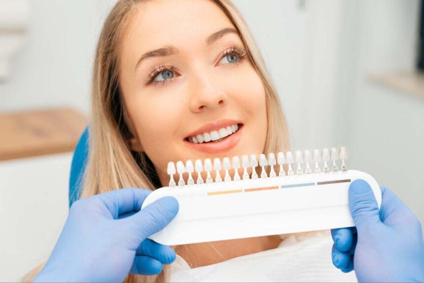 veneers