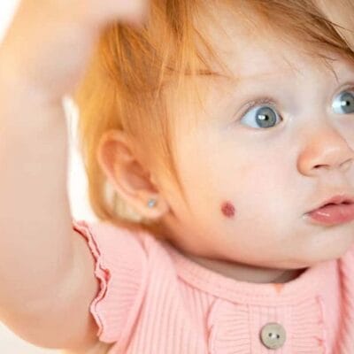 هل-علاج-الأورام-الوعائية-الدموية-فعال-على-المدى-الطويل؟