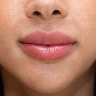 هل-علاج-شفاه-المدخنين-فعال-على-المدى-الطويل؟