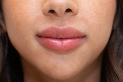 هل-علاج-شفاه-المدخنين-فعال-على-المدى-الطويل؟
