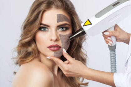 Can-Laser-Carbon-Peel-Clear-Acne-Quickly