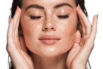 Can-Old-Skin-Stains-Fade-with-Melasma-Treatment