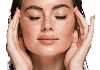 Can-Old-Skin-Stains-Fade-with-Melasma-Treatment