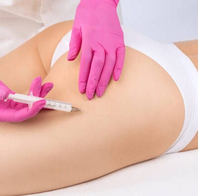 Does-Butt-Fillers-Help-Smooth-Dents-and-Hip-Indentations