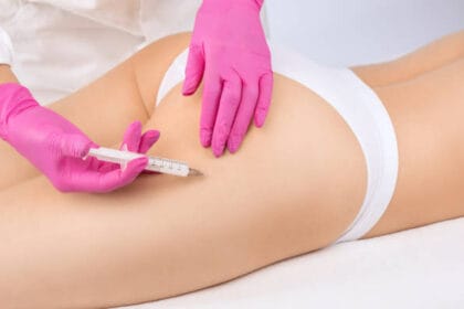 Does-Butt-Fillers-Help-Smooth-Dents-and-Hip-Indentations
