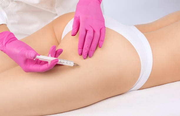 Does-Butt-Fillers-Help-Smooth-Dents-and-Hip-Indentations