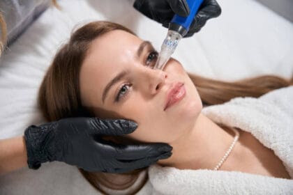 Does-Microneedling-Work-for-Uneven-Skin-Texture