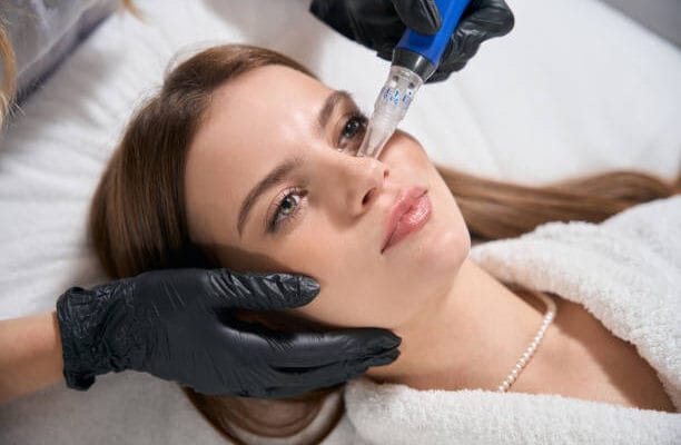 Does-Microneedling-Work-for-Uneven-Skin-Texture