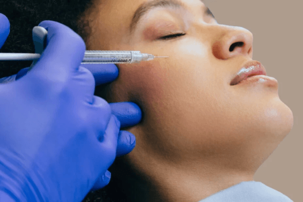 Does-Profhilo-Treatment-Improve-Skin-Texture