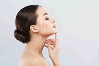 Dose-HIFU-Treatment-Really-Reduce-Wrinkles