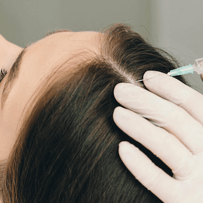 Exosome-therapy-hair-growth