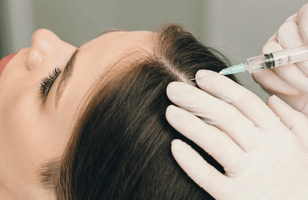 Exosome-therapy-hair-growth