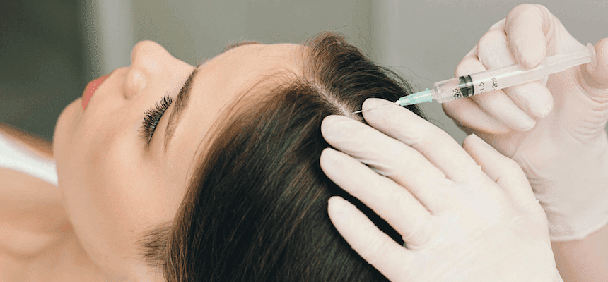 Exosome-therapy-hair-growth