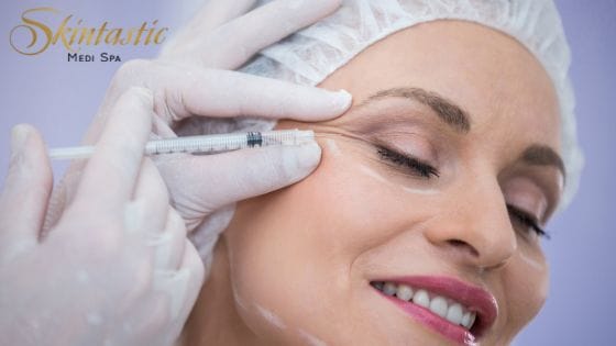 Flawless-Skin-with-Botox-in-Riverside