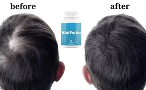 hairfortin