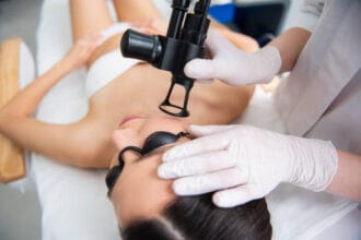 How-Quickly-Does-Pico-Laser-Fade-Acne-Scar-Appearance
