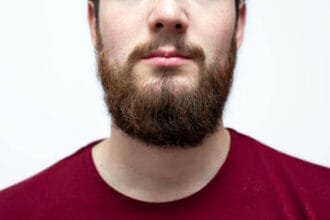 Is-Beard-Hair-Transplant-a-Good-Solution-for-Small-Beards