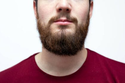 Is-Beard-Hair-Transplant-a-Good-Solution-for-Small-Beards