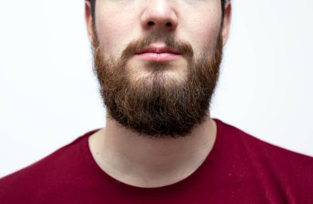 Is-Beard-Hair-Transplant-a-Good-Solution-for-Small-Beards