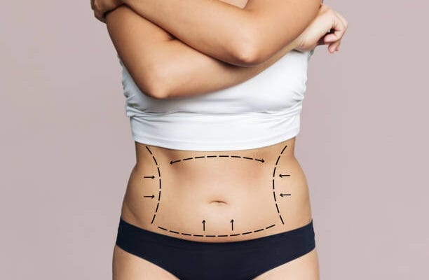 Is-Body-Jet-Liposuction-Good-For-Belly-Fat-Removal-Right