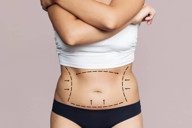 Is-Body-Jet-Liposuction-Good-For-Belly-Fat-Removal-Right