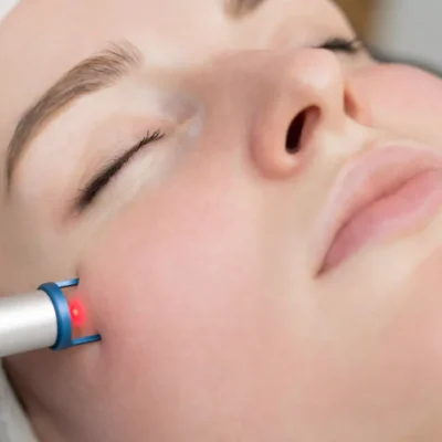 Is-Endolift-Recommended-for-Sagging-Skin-Around-the-Face