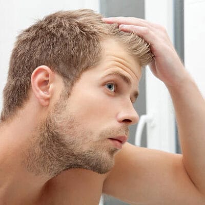Is-Hair-Transplant-Suitable-for-Thin-Hair
