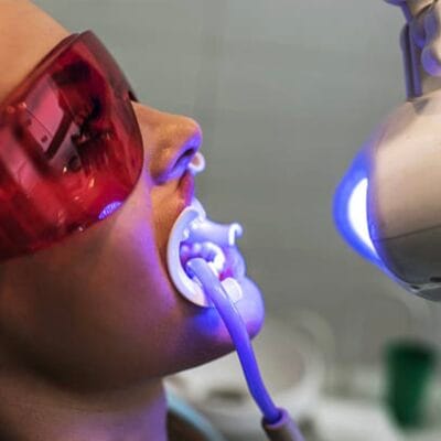 Philips-Zoom-Whitening-in-Mount-Roskill-Auckland