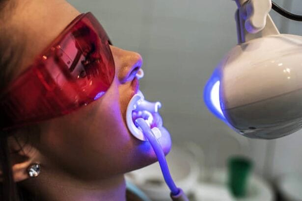 Philips-Zoom-Whitening-in-Mount-Roskill-Auckland