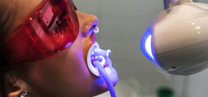 Philips-Zoom-Whitening-in-Mount-Roskill-Auckland