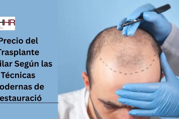 Precio-del-Trasplante-Capilar-Segun-las-Tecnicas-Modernas-de-Restauracio