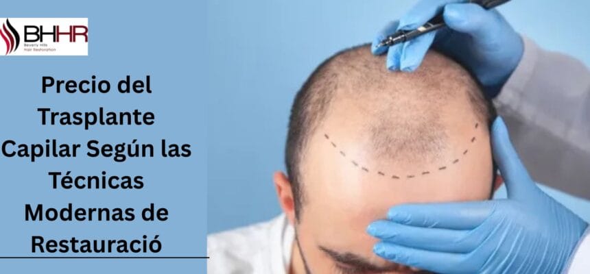 Precio-del-Trasplante-Capilar-Segun-las-Tecnicas-Modernas-de-Restauracio