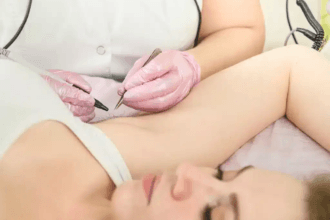 What-Electrolysis-Laser-Hair-Removal-Does