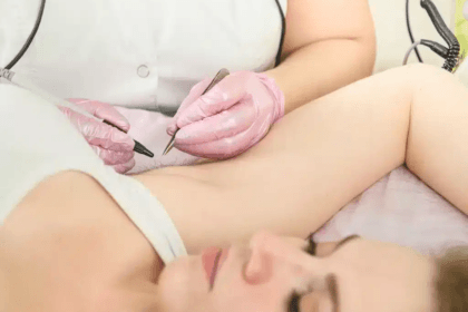 What-Electrolysis-Laser-Hair-Removal-Does
